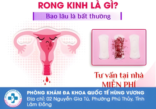 Khi nào được gọi là rong kinh?