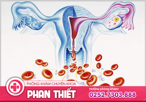 Âm đạo chảy máu sau quan hệ là tín hiệu của bệnh gì?