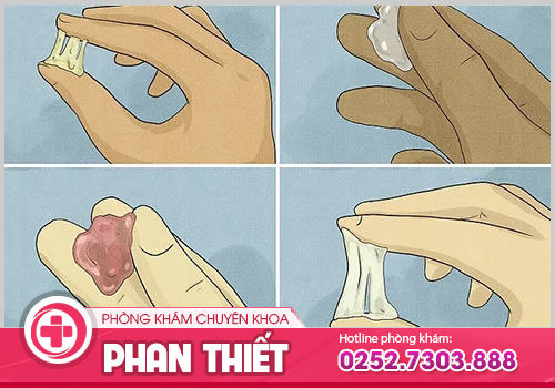 Bệnh khí hư là gì và cách chữa trị hiệu quả hiện nay?