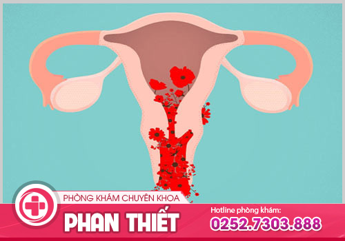 Bệnh xuất huyết tử cung bất thường báo hiệu điều gì?