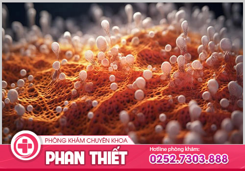 Cách điều trị nấm candida mang lại hiệu quả hiện nay là gì?