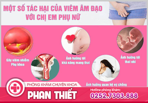 Cách trị viêm âm đạo an toàn, hiệu quả nhanh bằng kỹ thuật y khoa