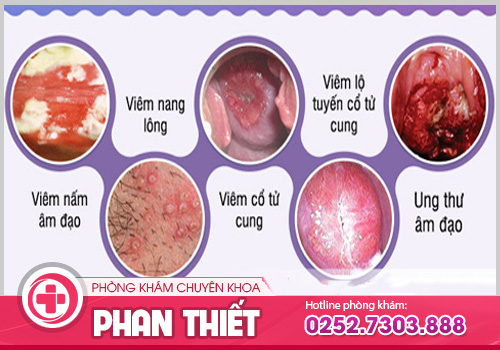 Bị đau vùng kín là dấu hiệu của bệnh gì?