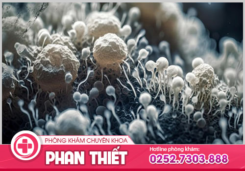 Cẩn thận với sức khỏe bằng cách khám chữa bệnh khi mắc phải nấm phụ khoa Candida 