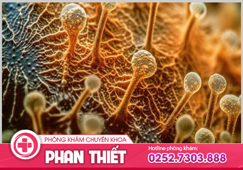 Hỗ trợ điều trị nấm Candida bằng thuốc