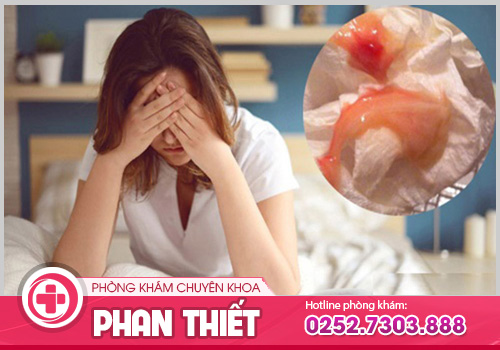 Huyết trắng có máu: Đừng chủ quan