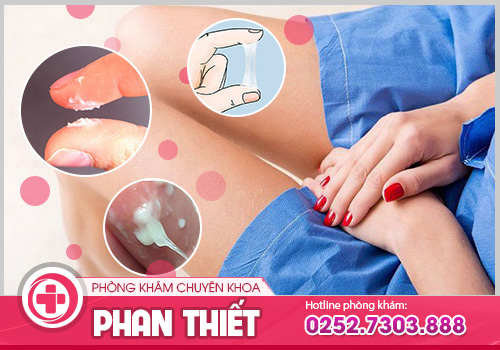 huyết trắng đục sệt