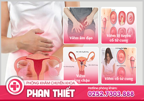 huyết trắng đục sệt