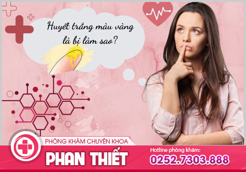 Huyết trắng màu vàng và cách điều trị hiệu quả