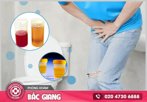 đi tiểu ra máu là bệnh gì