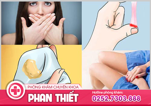 Những biểu hiện bệnh phụ khoa mà chị em không nên chủ quan