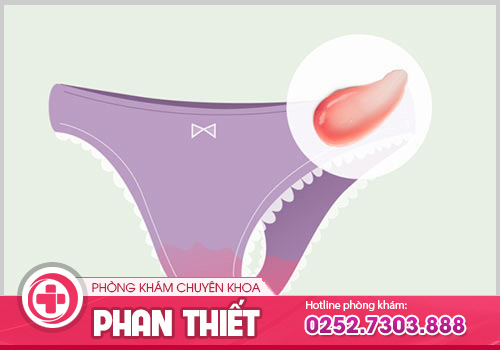 Khí hư có máu chớ nên xem thường ở nữ giới