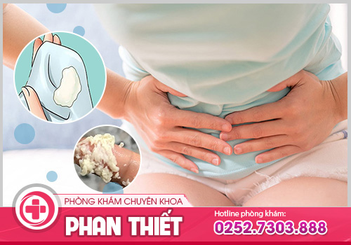 Khí hư màu trắng đục là dấu hiệu gì? Phân biệt bình thường và bệnh lý