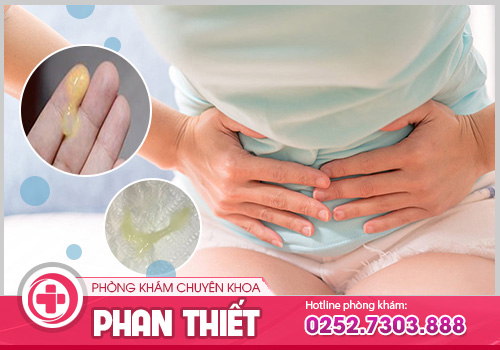 Khí hư màu vàng là triệu chứng bệnh gì? Cách điều trị hiệu quả