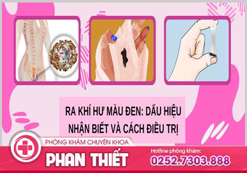 Khí hư màu đen có đáng lo ngại không? Điều trị như thế nào?