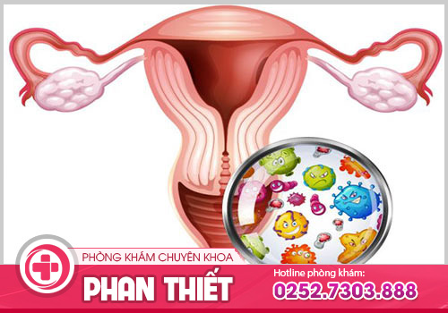 Khí hư màu vàng là triệu chứng bệnh gì? Cách điều trị hiệu quả