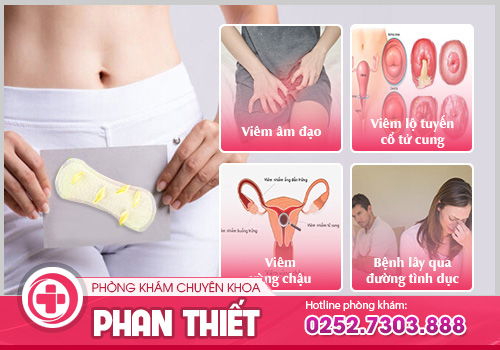 Khí hư màu vàng là triệu chứng bệnh gì? Cách điều trị hiệu quả