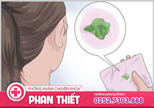 Khí hư màu xanh giống nước mũi là bệnh gì?