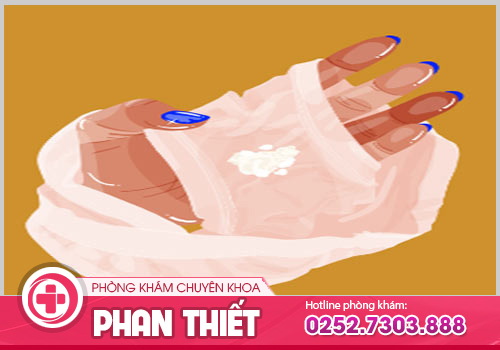 Khí hư vón cục là dấu hiệu cảnh báo bệnh gì?