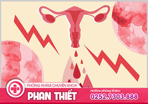 Không nên bỏ qua nguyên nhân kinh nguyệt ra máu nhiều?