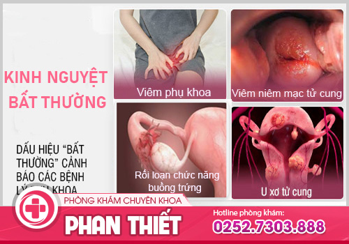 Khi kinh nguyệt bất thường cảnh báo điều gì?