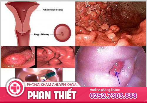 Hiện tượng kinh nguyệt đến sớm có đáng lo!