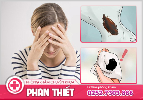 Những tác hại của kinh nguyệt màu đen mà bạn cần lưu ý?