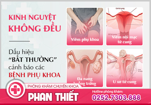 Kinh nguyệt không đều cảnh báo các bệnh phụ khoa nguy hiểm