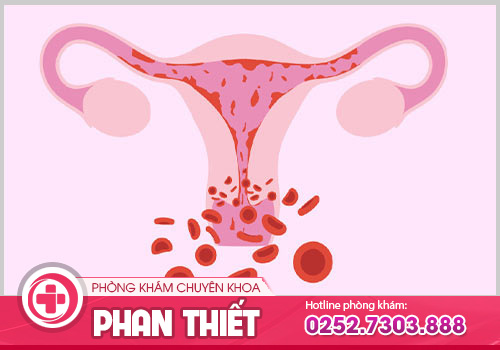 Kinh nguyệt ra máu nhiều có ảnh hưởng gì không?