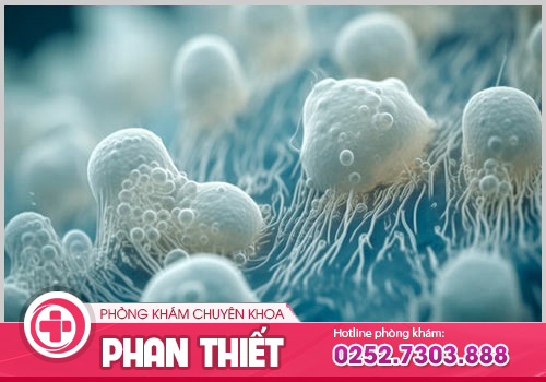 Nấm Candida vùng kín có nguy hiểm không? Cách khắc phục hiệu quả