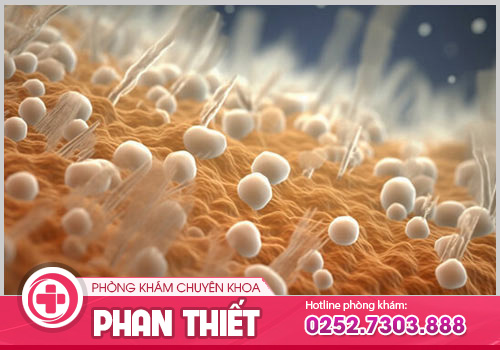 Nấm phụ khoa là gì và những điều bạn cần biết