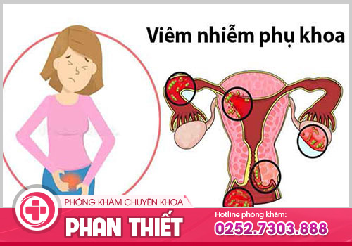 Nguyên nhân mắc bệnh viêm phụ khoa mà nữ giới cần biết?