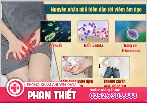 Viêm âm đạo -Bệnh phụ khoa phổ biến nhưng không thể chủ quan
