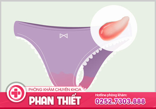 Nhận thấy khí hư có máu không nên xem thường