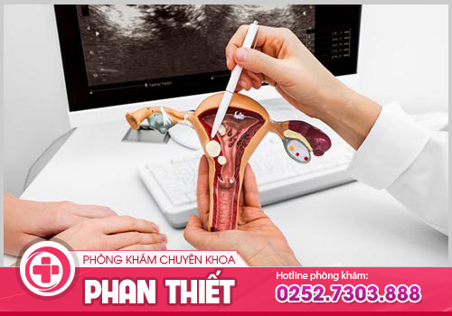 Những biểu hiện bệnh phụ khoa mà chị em không nên chủ quan