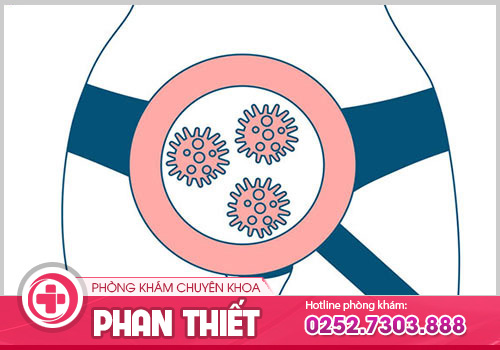 Những yếu tố nào gây nên ngứa rát vùng kín?