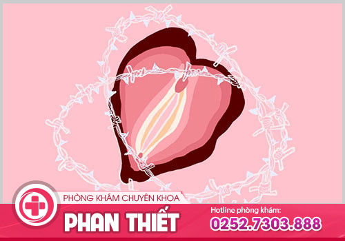 Nữ giới bị đau rát âm đạo bởi yếu tố nào gây ra?