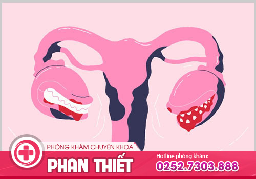 Nữ giới bị tắc kinh 2 tháng chớ xem thường