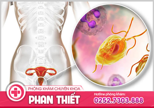 Nữ giới bị viêm nhiễm phụ khoa có có dấu hiệu nào hay không?