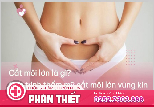 Phẫu thuật cắt môi lớn - Bí quyết giữ gìn thanh xuân cho chị em