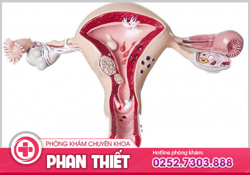 Phì đại cổ tử cung là gì? Nguyên nhân, Biến chứng và Địa chỉ điều trị