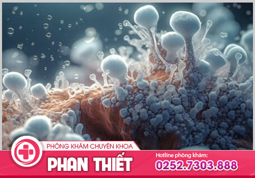 Phương pháp nào có thể hỗ trợ điều trị nấm âm đạo khả quan?