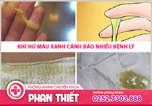 Ra dịch trắng màu xanh: Nguyên nhân, dấu hiệu và cách điều trị