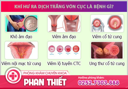 Nguyên nhân vùng kín bị ngứa ra dịch trắng vón cục