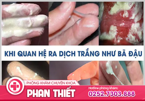 Nguyên nhân vùng kín bị ngứa ra dịch trắng vón cục
