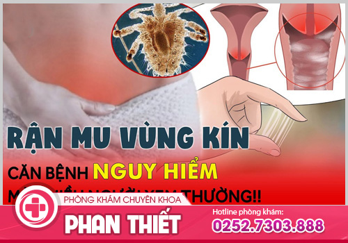 Rận mu - Bệnh nguy hiểm chớ chủ quan!