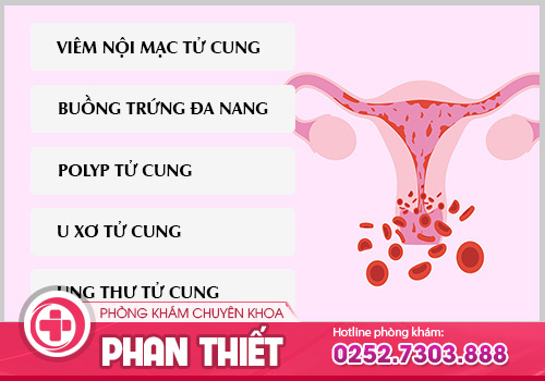 Rong kinh - Mối hiểm họa khôn lường đối với sức khỏe nữ giới