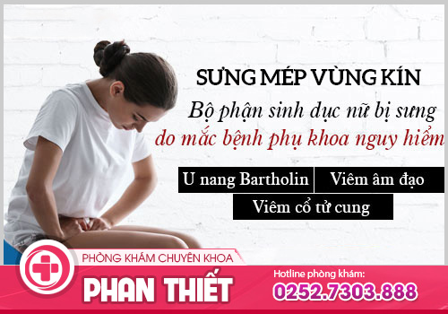 Sưng mép vùng kín - Dấu hiệu cảnh báo viêm nhiễm cơ quan sinh dục