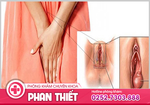 Sưng mu vùng kín là dấu hiệu nhận biết bệnh gì?