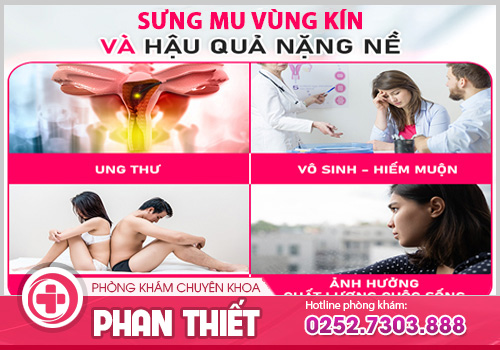 Sưng mu vùng kín là dấu hiệu nhận biết bệnh gì?
